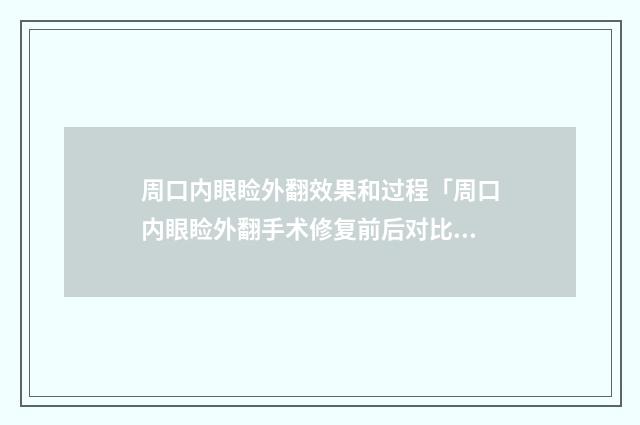 周口内眼睑外翻效果和过程「周口内眼睑外翻手术修复前后对比效果图」