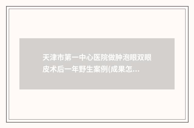 天津市第一中心医院做肿泡眼双眼皮术后一年野生案例(成果怎么样?技术特点) 天津市第一中心医院2025年招聘