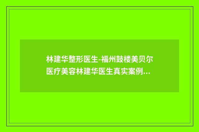 林建华整形医生-福州鼓楼美贝尔医疗美容林建华医生真实案例评价看性价比高