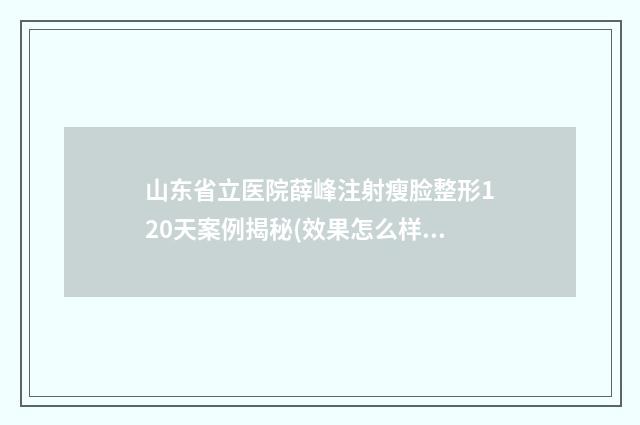 山东省立医院薛峰注射瘦脸整形120天案例揭秘(效果怎么样?技术风格) 山东省立医院薛文君