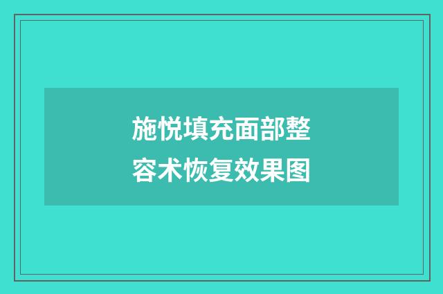 施悦填充面部整容术恢复效果图