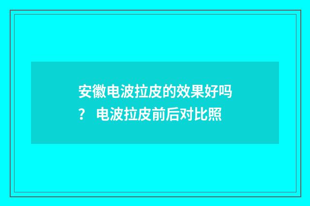 安徽电波拉皮的效果好吗？ 电波拉皮前后对比照