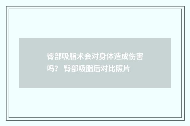 臀部吸脂术会对身体造成伤害吗? 臀部吸脂后对比照片