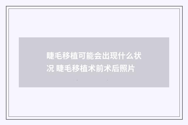 睫毛移植可能会出现什么状况 睫毛移植术前术后照片