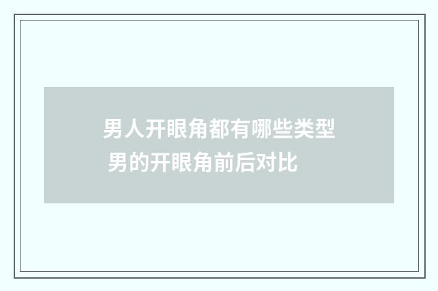 男人开眼角都有哪些类型 男的开眼角前后对比