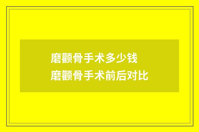 磨颧骨手术多少钱 磨颧骨手术前后对比
